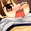 NG肾